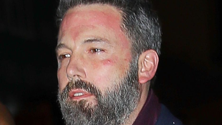 Ben Affleck walczy z uzależnieniem
