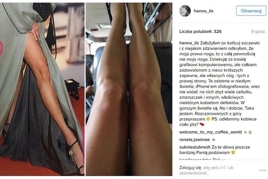 Hanna Lis o retuszu swoich nóg napisała na Instagramie