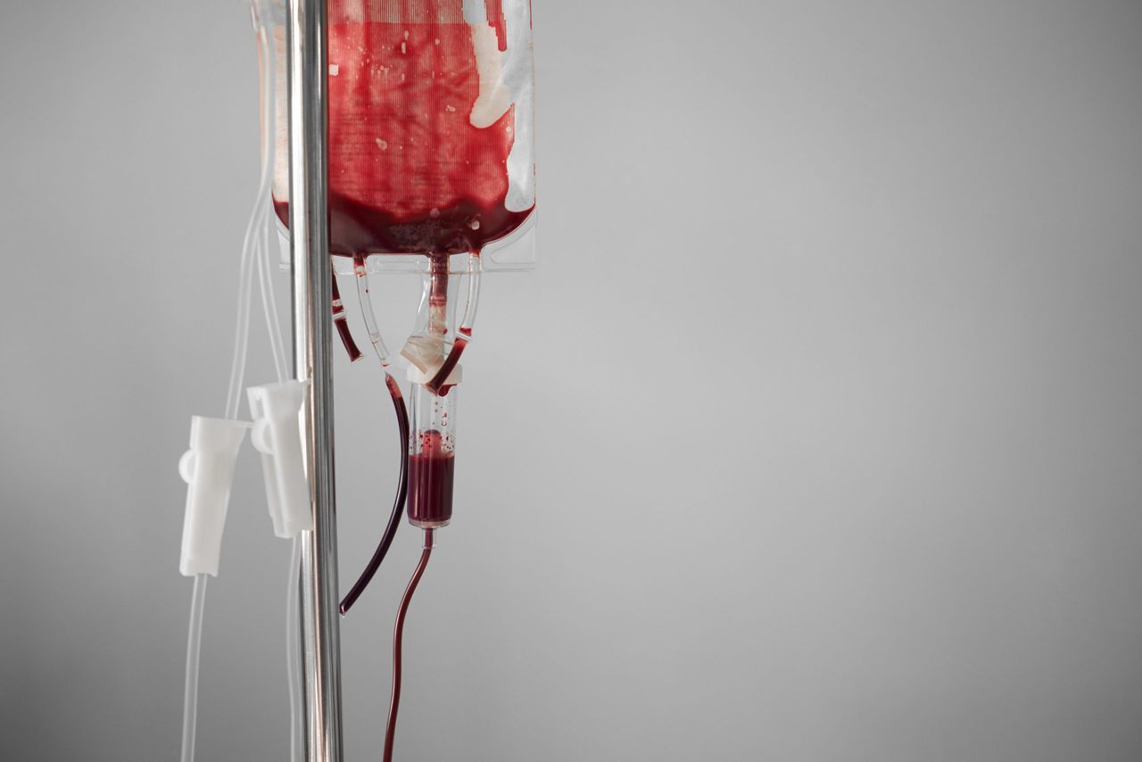 Blood transfusion. Empty bag on stand. Blue background with copy space