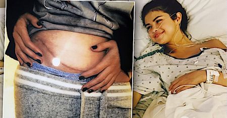 Selena Gomez była o krok od śmierci. Jak wspomina traumatyczne chwile przed przeszczepem nerki?