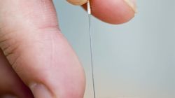 Akupunktura - galeria