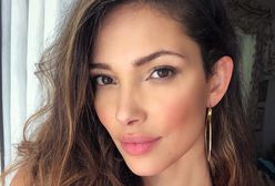 Modelka Victoria’s Secret pozywa hotel i pokazuje ślady po pogryzieniu przez robaki