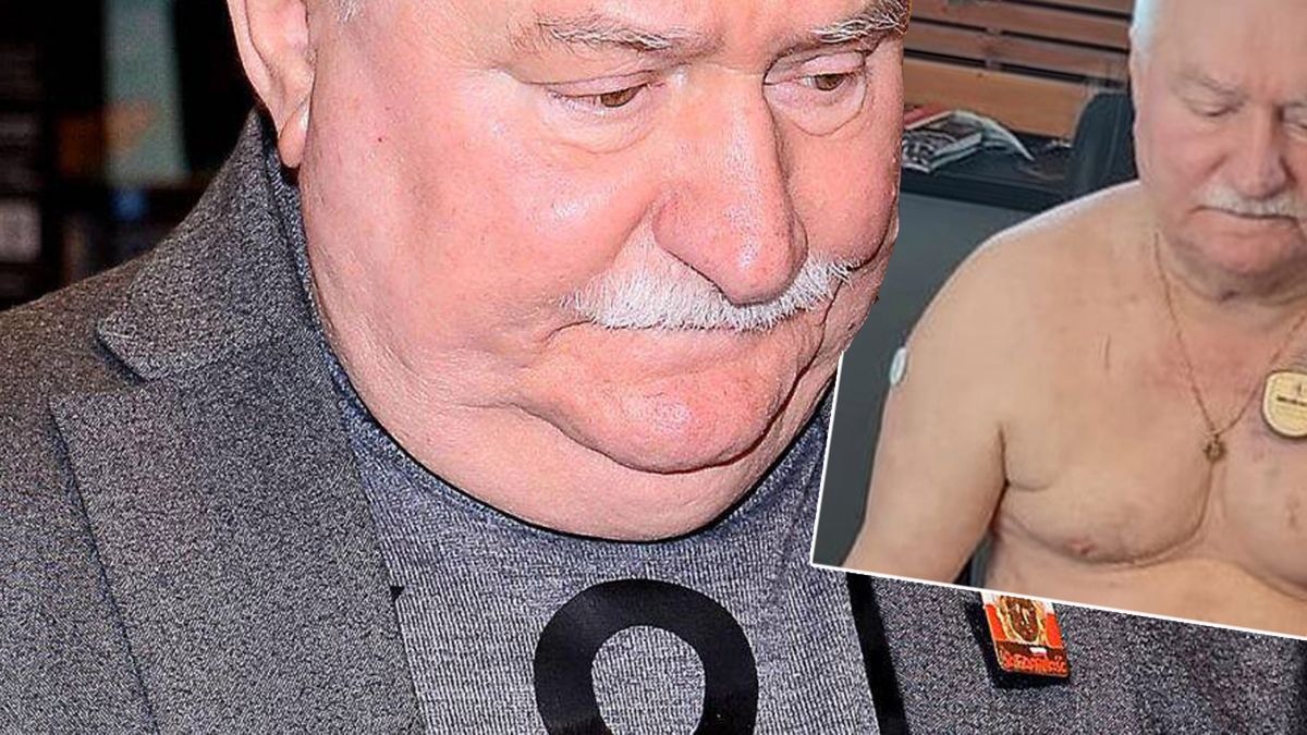 Lech Wałęsa pokazał dużą ranę po operacji serca. Boli od samego patrzenia