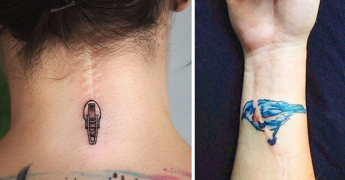 16 Extraordinary Tattoos Turning Scars and Other Imperfections into Masterpieces