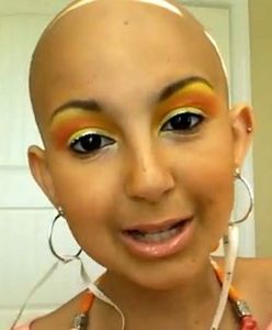 Chora na raka 13-latka została twarzą firmy kosmetycznej