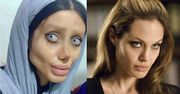 Lekarze zrobili z niej potwora. Chciała być podobna do Angeliny Jolie