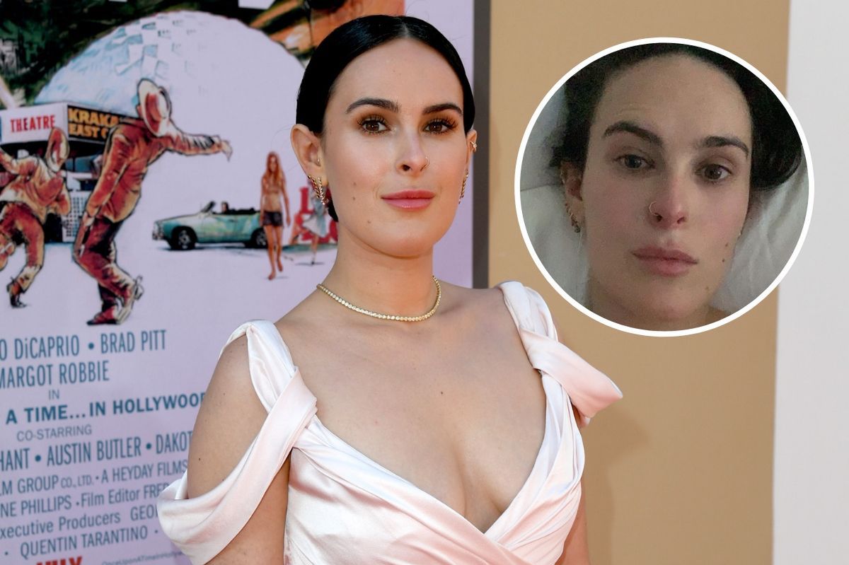 Rumer Willis, córka Bruce’a Willisa i Demi Moore, cierpi na "tajemniczą chorobę"