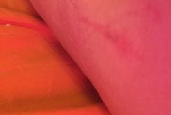 Izrael. Koszmarnie potraktowali niepełnosprawną Polkę. "Zabrali mi wózek, prawie rozebrali"