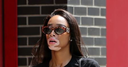 Czarnoskóra modelka z bielactwem. Winnie Harlow wybiera kultowe Vansy