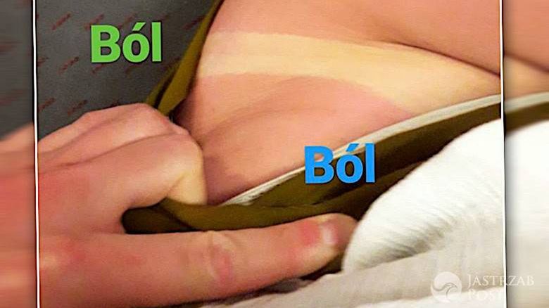 Natalka z M jak miłość, Marcjanna Lelek przesadziła z opalaniem