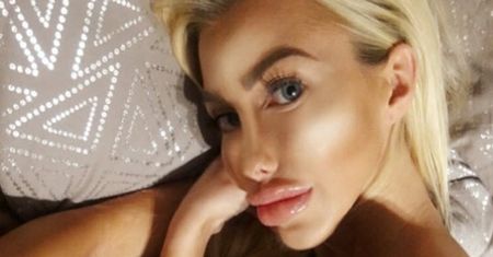 Zobaczcie jak wyglądała "polska Barbie" przed operacjami! Nie do poznania?