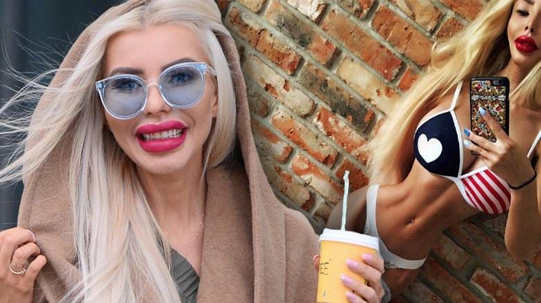 Anella przed operacjami