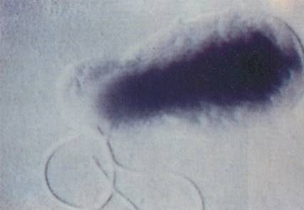 Mikroskopowy obraz bakterii bartonella 
