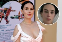 Rumer Willis, córka Bruce’a Willisa i Demi Moore, cierpi na "tajemniczą chorobę"