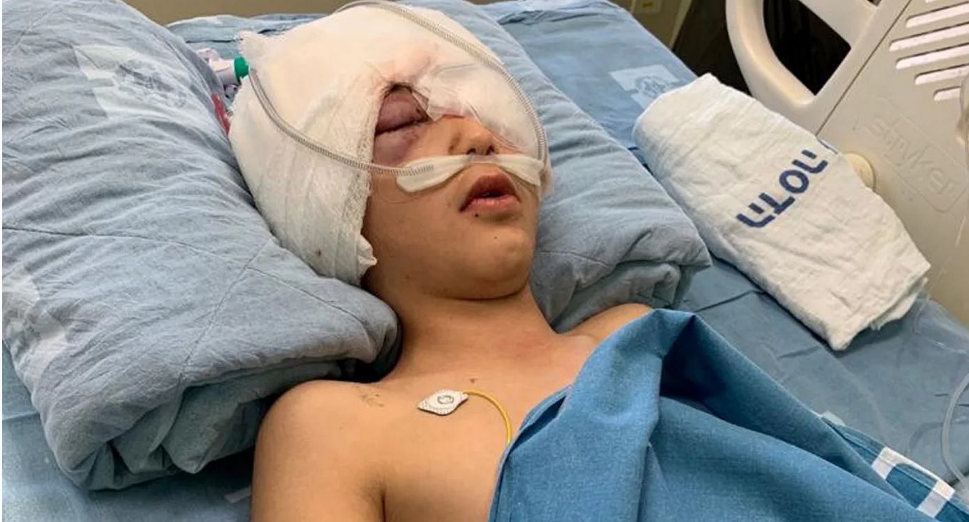 Izrael. Dziecko postrzelone przez żołnierza. Oburzenie w Palestynie