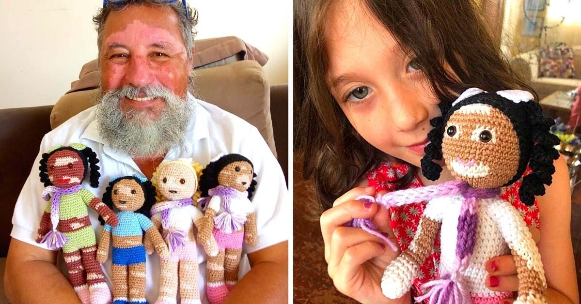 A Brazilian Granddad Crochets Dolls That Look like Children Suffering from Vitiligo