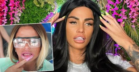 Katie Price wstawiła licówki w Turcji. Teraz wszystkie zęby jej odpadają!