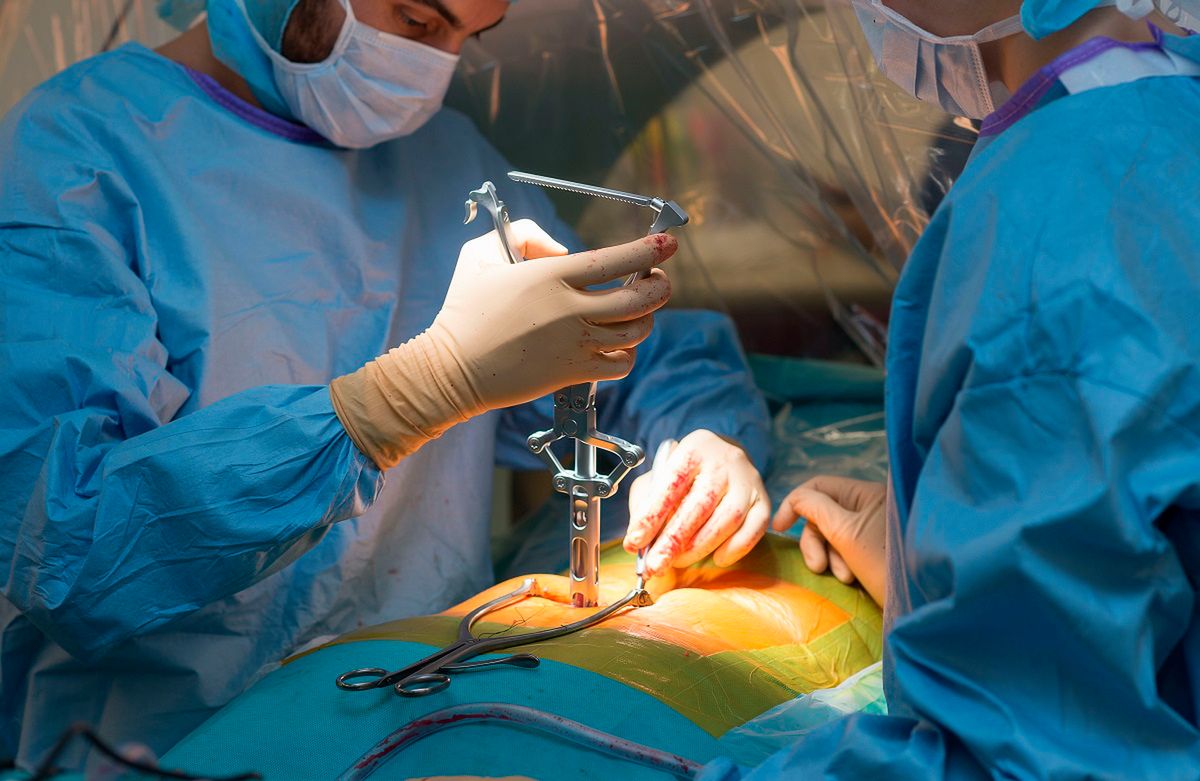 Lekarze z Instytutu Rizzoli w Bolonii po raz pierwszy na świecie przeszczepili pacjentowi część kręgosłupa od dawcy.