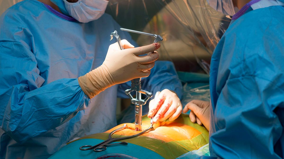 Lekarze z Instytutu Rizzoli w Bolonii po raz pierwszy na świecie przeszczepili pacjentowi część kręgosłupa od dawcy.