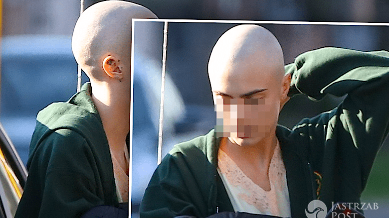 Cara Delevingne łysa