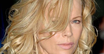Kim Basinger przeciwko eksperymentom na psach