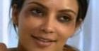 Kim Kardashian pokazała się w programie z podbitymi oczami!
