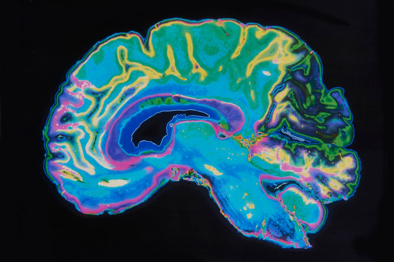 Naukowcy odkryli nową część mózgu. Prawdopodobnie odpowiada za odczucia duchowe