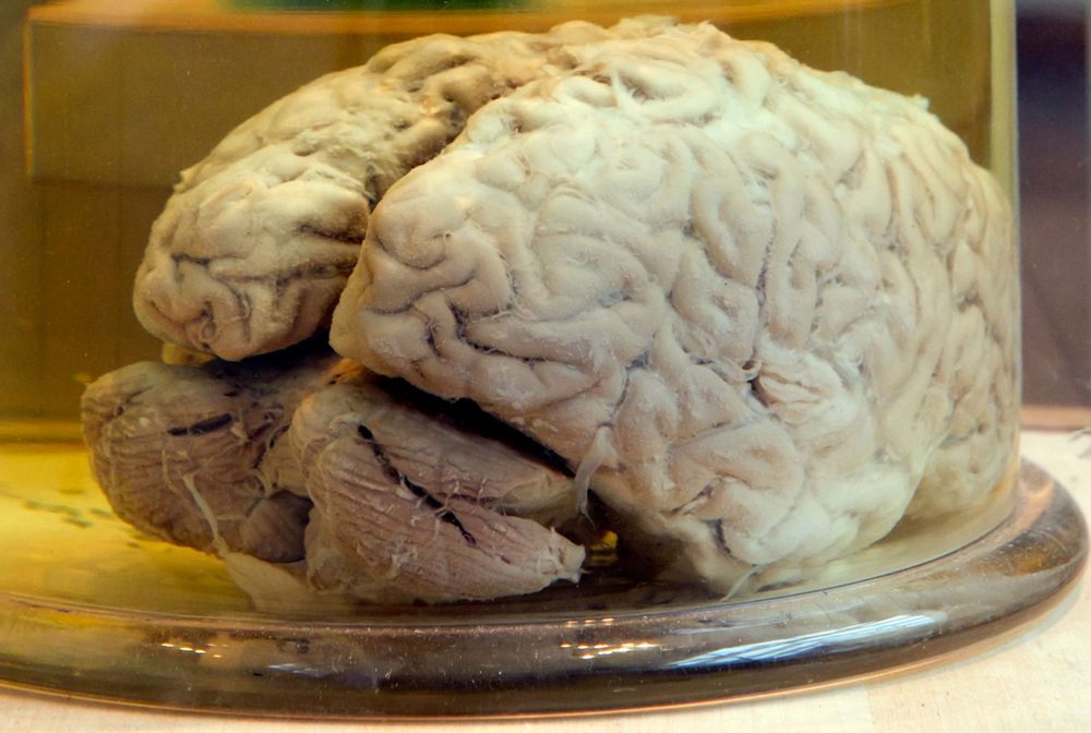 Niezwykłe odkrycie. 45 mózgów w grobie masowym