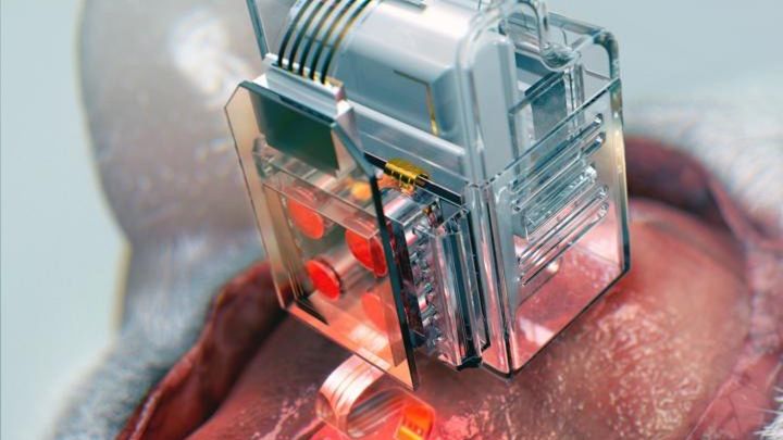 Implant umieszczony w mózgu myszy laboratoryjnej