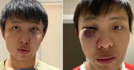 Rasistowski atak na studenta z Singapuru. Powodem koronawirus