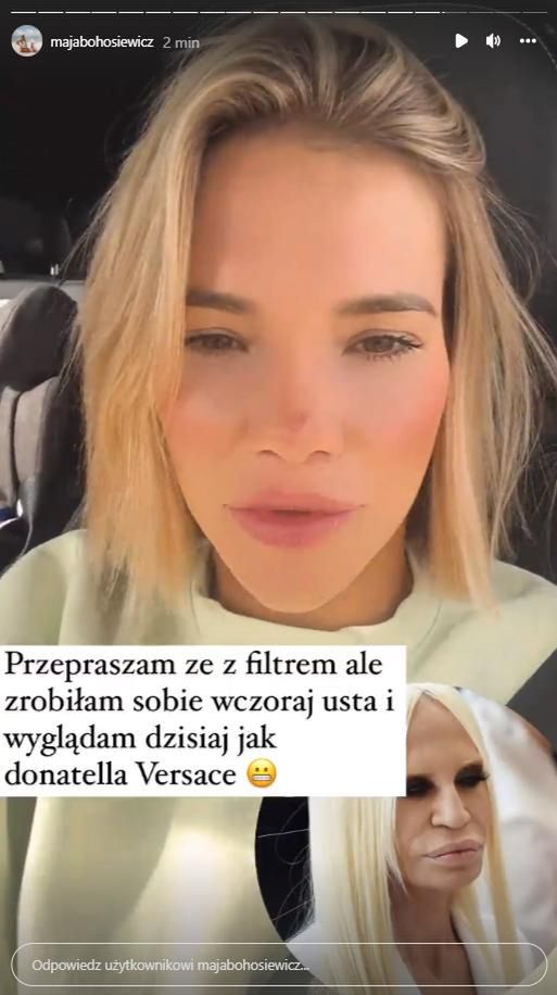 Maja Bohosiewicz powiększyła usta?
