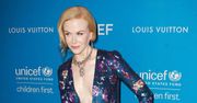 Nicole Kidman: milimetry dzieliły ją od wpadki