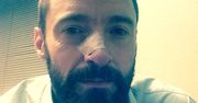 Hugh Jackman po trzeciej operacji usunięcia nowotworu!