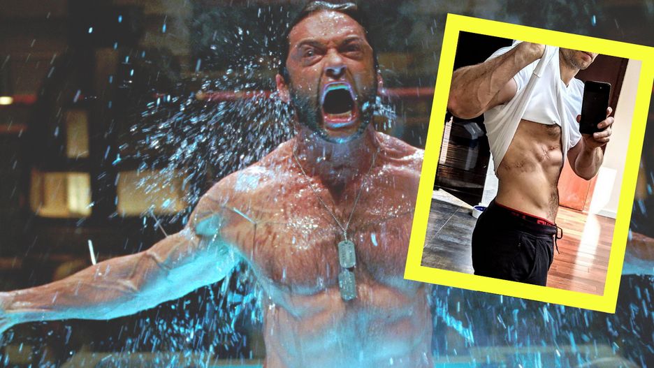 Wybrali nowego Wolverine'a? 
