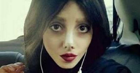 "Zombie Angelina" pokazała zdjęcia sprzed operacji