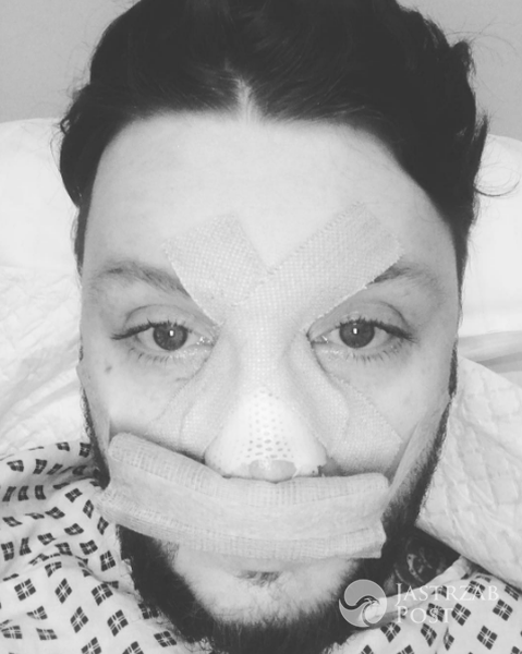 James Arthur pokazał zdjęcie ze szpitala