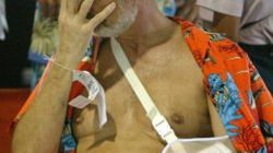 Lekko ranny, pozostający w szoku Niemiec Wilfred Bretz, w Phuket w Tajlandii