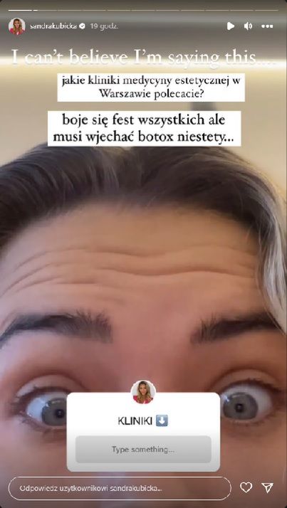 Sandra Kubicka pokazała zmarszczki