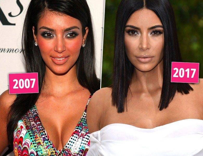 Kim Kardashian - kiedyś i dzisiaj, metamorfoza