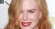 Nicole Kidman nadużywa botoksu?