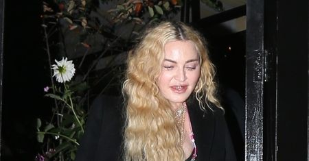 Madonna przesadziła z wypełniaczami. Tak źle jeszcze nie wyglądała