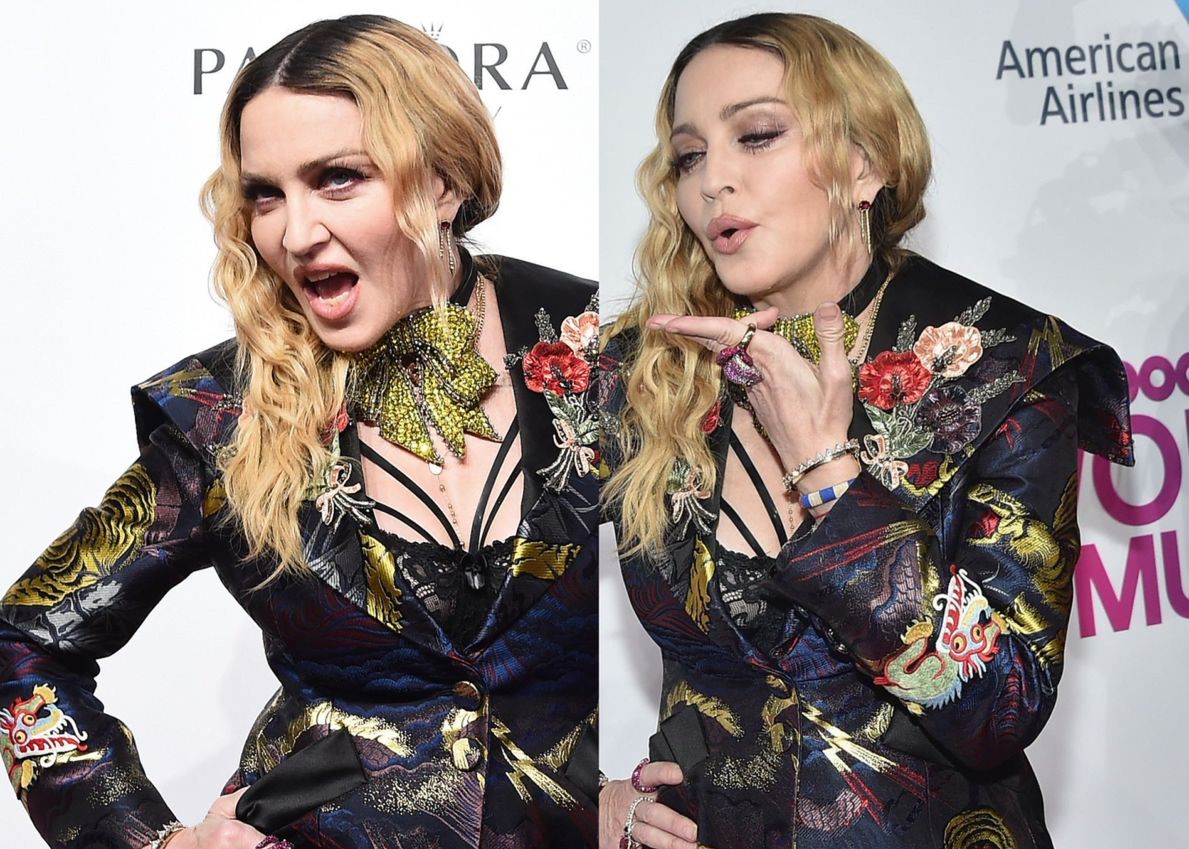 Madonna nie przestaje eksperymentować z twarzą