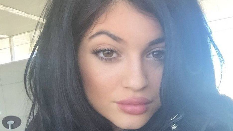 Kylie Jenner po operacji