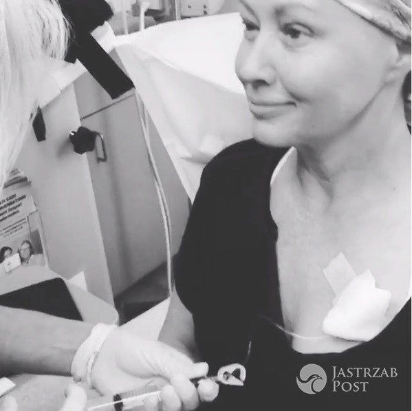 Shannen Doherty chemioterapia
