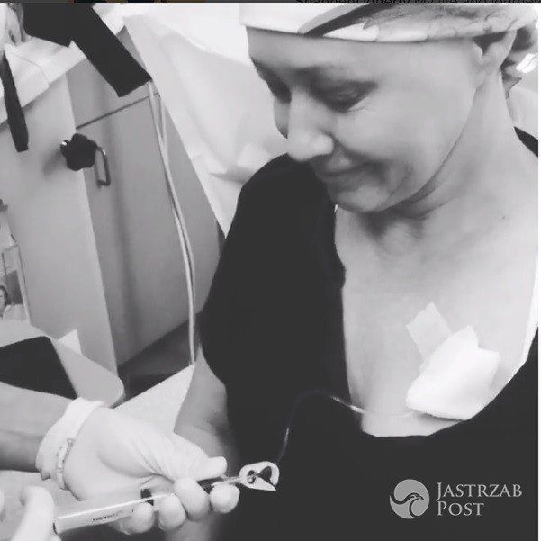 Shannen Doherty chemioterapia