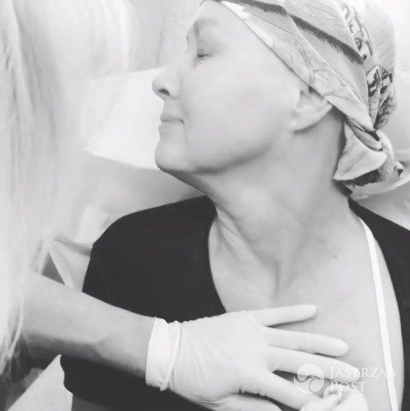 Shannen Doherty chemioterapia