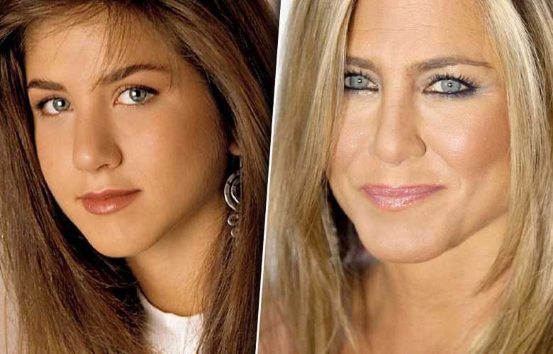 Jennifer Aniston miała operację plastyczną nosa? Zdjęcia przed i po