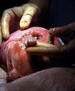 To jedno z najsłynniejszych zdjęć na świecie. Dziecko z fotografii ma dziś 18 lat