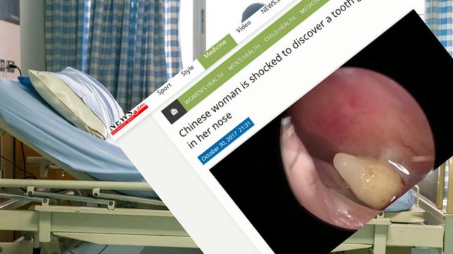 57-latka poznała zaskakującą diagnozę