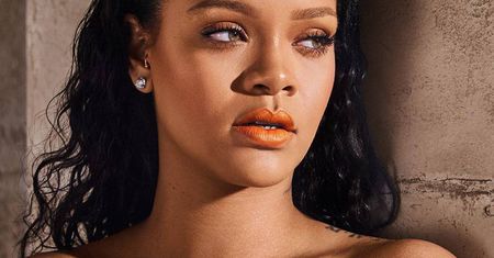 Rihanna uległa poważnemu wypadkowi. Zdjęcia posiniaczonej gwiazdy trafiły do sieci